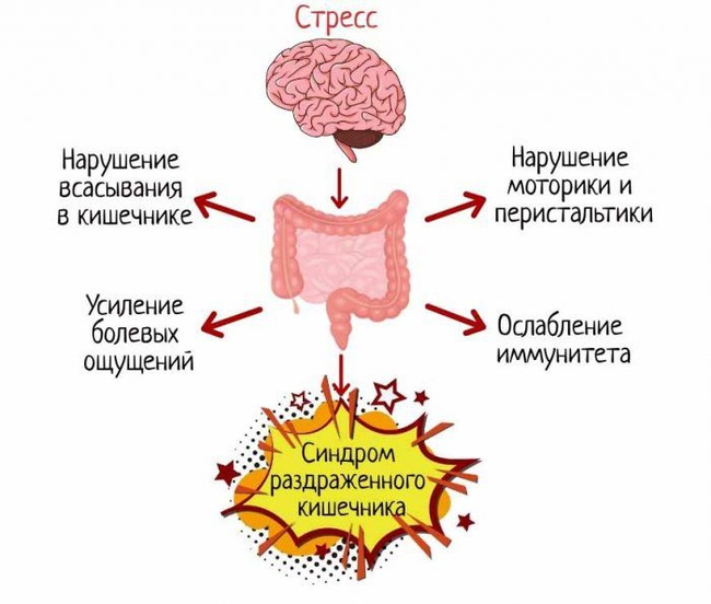 Синдром стула